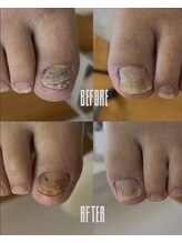 おん/足爪のケア