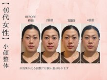 サクラ(SAKURA)/【40代】Before  After