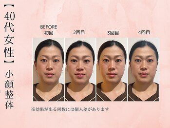 サクラ(SAKURA)/【40代】Before  After