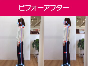 あい鍼灸院 接骨院 イオンタウン豊中緑丘院/ビフォーアフター