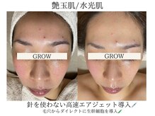 グロウ バイ フェイシャルデザイン アンド アイ(GROW)の雰囲気（なりたいお肌改善をパーソナルでご提案♪）