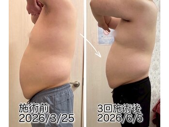 クールスパ(COOL SPA)/20代男性
