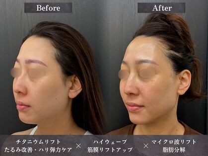 イロハ(IROHA)の写真