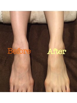 ウルル 栄店(ULULU)/フォト美顔の光でトーンアップ☆