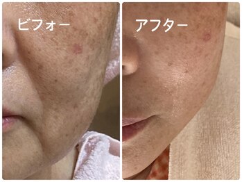 ノーブル シャット Noble Chate/大人女性の悩みを解決◎集中ケア