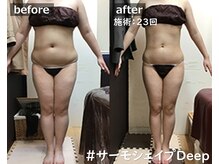 セレブリボーン 芦屋店の雰囲気（辛い運動なし・食事制限なし・リバウンドなしでサイズダウン）