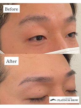 プラチナムブロウ 新潟(PLATINUM BROW)/美眉スタイリングのお客様（20代