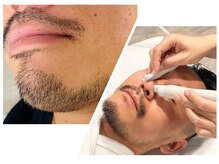 マリア(MALIA)の雰囲気（男性も全身脱毛や、毛穴洗浄で多数ご来店！ご相談下さい。）
