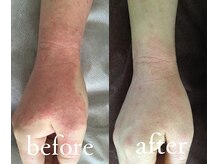 トリートメントルーム フェリーチェ(Felice)/ボディ悩みにもハーブエステは◎