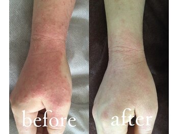 トリートメントルーム フェリーチェ(Felice)/ボディ悩みにもハーブエステは◎