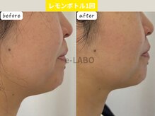 イーラボ 池袋店(e-LABO)の雰囲気（レモンボトル導入で小顔に！【小顔./レモンボトル】）