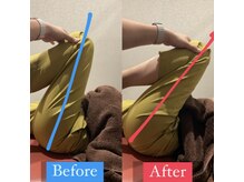 ナオル整体 宮崎院(NAORU整体)/40代女性施術事例【股関節改善】