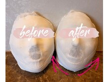 カンコルギセラピー 広島幟町店(KAN)の雰囲気（お顔の下半身がスッキリ！余白が少なくなると小顔効果◎）