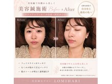 ロミハリ(LomiHari)