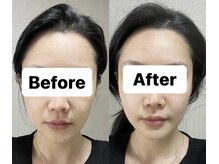 オプレア 千種店(OPREA)/【比較写真】7D