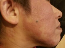 サロン ド ラマン メジロ(Salon de Lamain .mejiro)/モンスターフェイス体験者の私