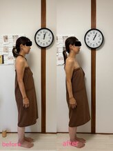 ルアナ(LUANA)/ヘッドスパ、before→after