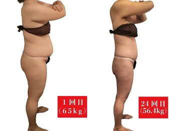 アマンシィ(Amincir)/【Before/After】エンダモロジー