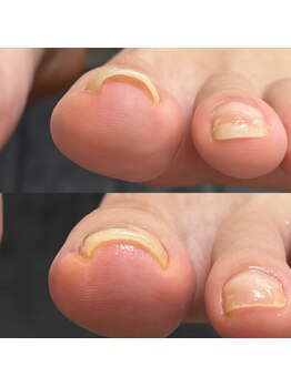 リラフ(Re:laugh)/