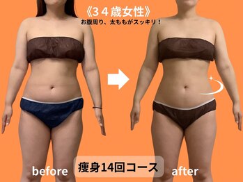 モア 多治見店(MORE)/お客様ビフォーアフター