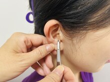 ふーみん/耳つぼ施術