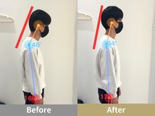 せなかのはね 井尻店/20代　猫背　ストネ　背中の張り