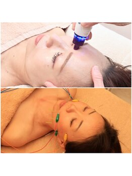 ベルシャ(Belle Chat)の写真/[毛穴洗浄&美容鍼&小顔矯正]史上最高の美肌が叶う究極コース★最先端ハイドロと美容鍼の融合!