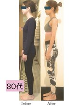 サリー(Sally)/姿勢　Bfore After