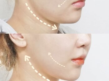 エムズビューティスタジオ エステ リラク 西川口店(M's Beauty Studio)/たるみ改善/西川口駅