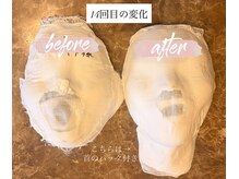 カンコルギセラピー 広島幟町店(KAN)の雰囲気（お客様も驚くほどの変化！効果を感じていただいております(^^♪）