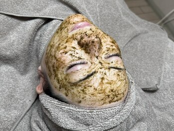 キュアルーム(CURE ROOM)の写真/《剥離なしのハーブピーリング》厳選国産ハーブの力が肌に穏やかに作用し、毛穴・肌悩み・ニキビ改善♪