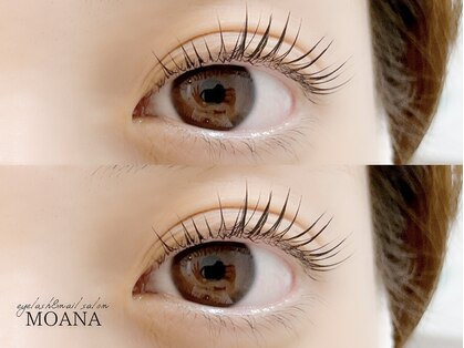 モアナ なんば店(MOANA)の写真