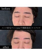 ユー 千葉駅前店(you)/ビフォ－アフター写真