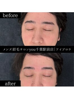 ユー 千葉駅前店(you)/ビフォ－アフター写真