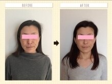 美容整体ウェリナ あま甚目寺院/小顔矯正/骨盤矯正/美脚サロン