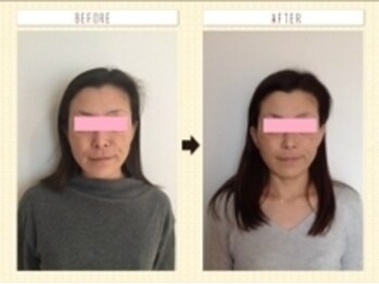 美容整体ウェリナ あま甚目寺院/小顔矯正/骨盤矯正/美脚サロン