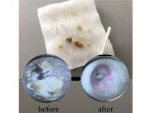 オスマンサス(Osmanthus)/before→after