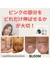 ブルームブルーム(BLOOMブルーム)/リプロネイルとは