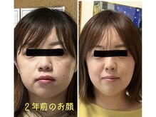 エンプレス ユミエル(Empress Yumiel)/通い続けた結果のお顔