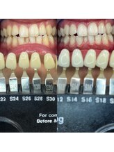 トウキョウスワーズ 池袋店(TOKYO SWRS)/#ホワイトニング #池袋 #渋谷