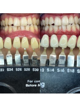 トウキョウスワーズ 池袋店(TOKYO SWRS)/#ホワイトニング #池袋 #渋谷