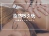 《術前・術後ケア専用》ダウンタイム短縮インディバ60分【ボディ】¥12000