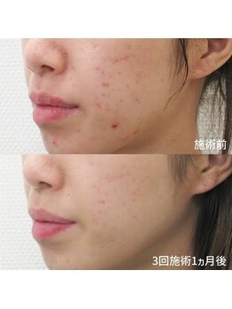 スリリアン 銀座/★お客さまビフォーアフター★