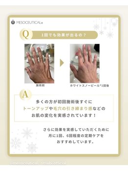 ココ 2号店(CoCo)/ホワイトスノーピール