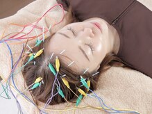 こころ晴れ鍼灸院の雰囲気（抜毛・顔のたるみ・シワの改善、小顔など美容効果もあります！）