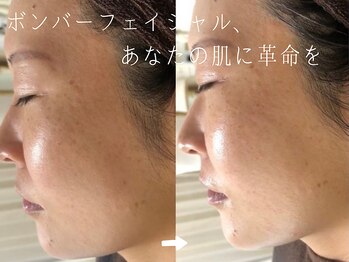 サロンドシエル カスガイ(Salon de Ciel kasugai)/たるみも毛穴も、肌ごとリセット