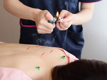 ときのはり鍼灸院(TOKINOHARI)の雰囲気(国家資格あり!鍼とお灸を使い分け女性特有のお悩みにアプローチ)