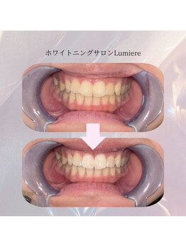 ルミエール 名古屋(Lumiere)の写真/「笑うのが楽しくなる毎日」をお手伝い♪通いやすい価格とアットホームな空間で、お悩みに寄り添います◎