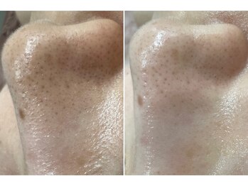 トータルビューティーサロン ナーズ(NAZ)/