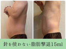 ソルニスデュオ(Solnis.-duo-)/痩身/酵素浴/毛穴/よもぎ蒸し